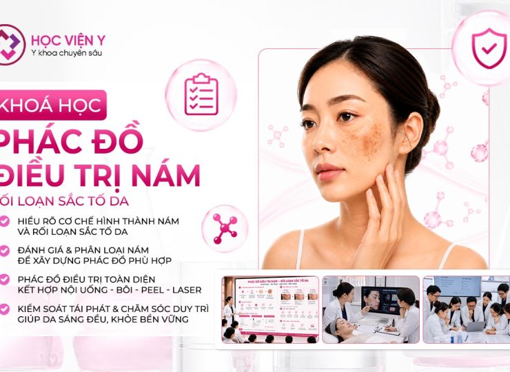 phác đồ điều trị nám