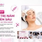 ĐIỀU TRỊ NÁM CHUYÊN SÂU VỚI LASER VÀ TIÊM MESO