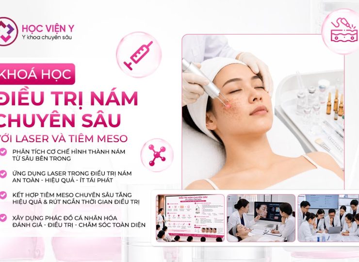 điều trị nám chuyên sâu với laser và tiêm meso