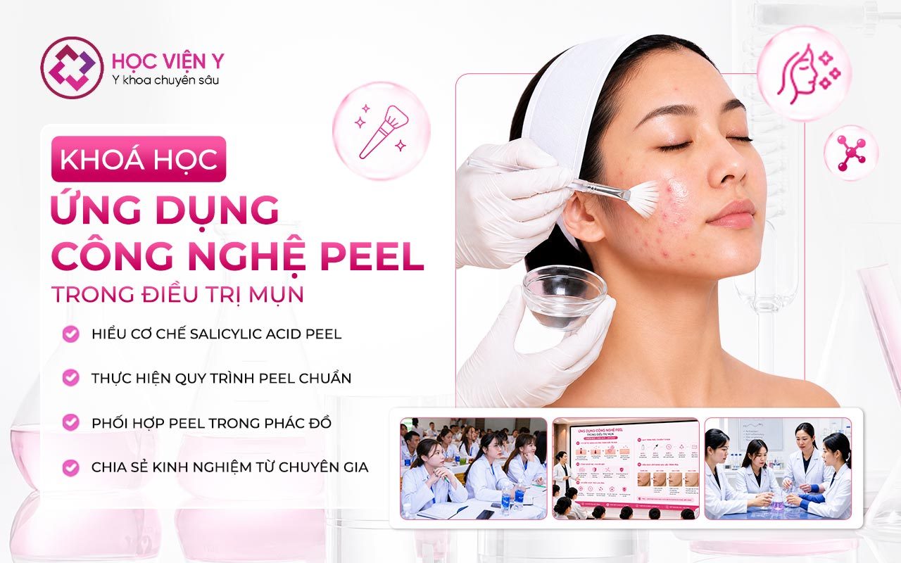 ứng dụng công nghệ peel