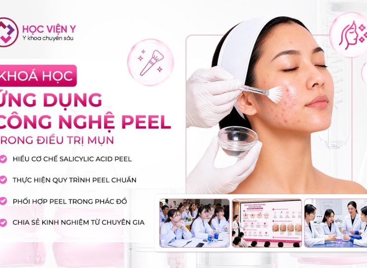 ứng dụng công nghệ peel