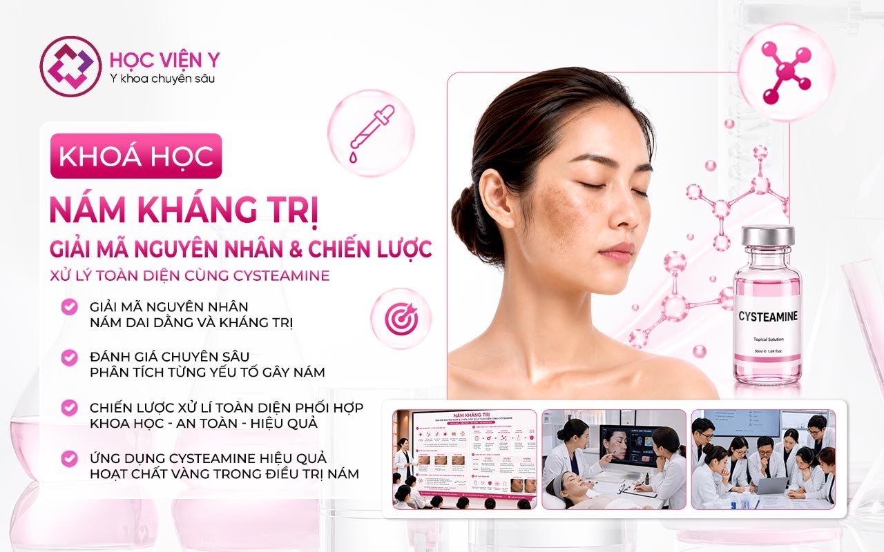 nám kháng trị giải mã nguyên nhân và chiến lược xử lí toàn diện cùng Cysteamine