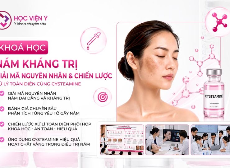 nám kháng trị giải mã nguyên nhân và chiến lược xử lí toàn diện cùng Cysteamine