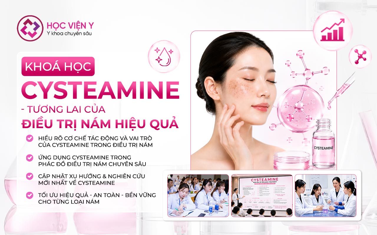 cysteamine tương lai của điều trị nám hiệu quả