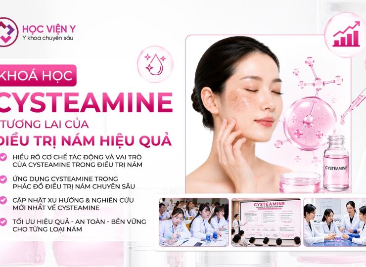 cysteamine tương lai của điều trị nám hiệu quả