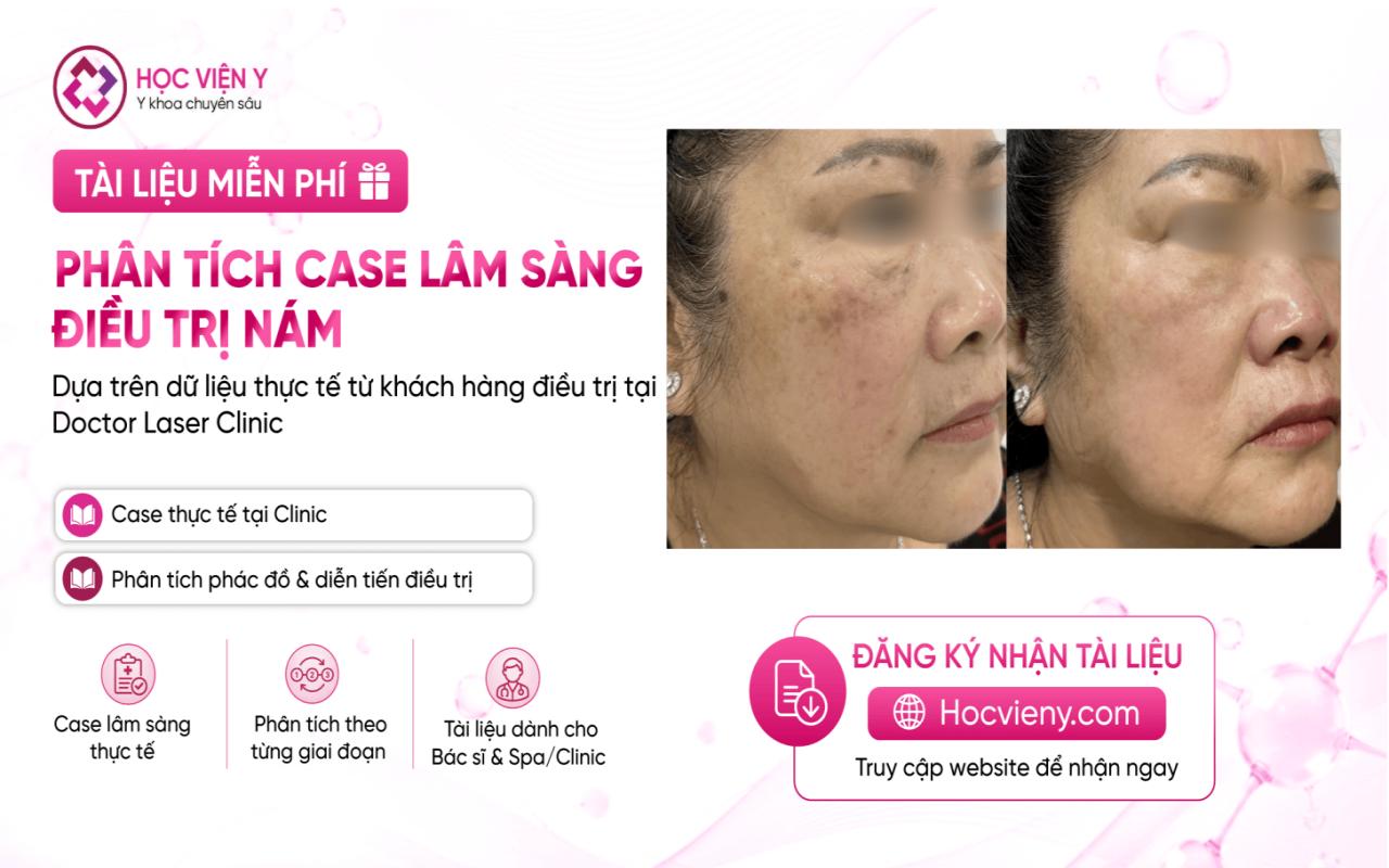 tài liệu trị nám